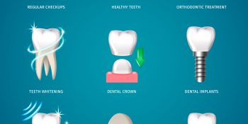 Diş İmplant Tedavisi